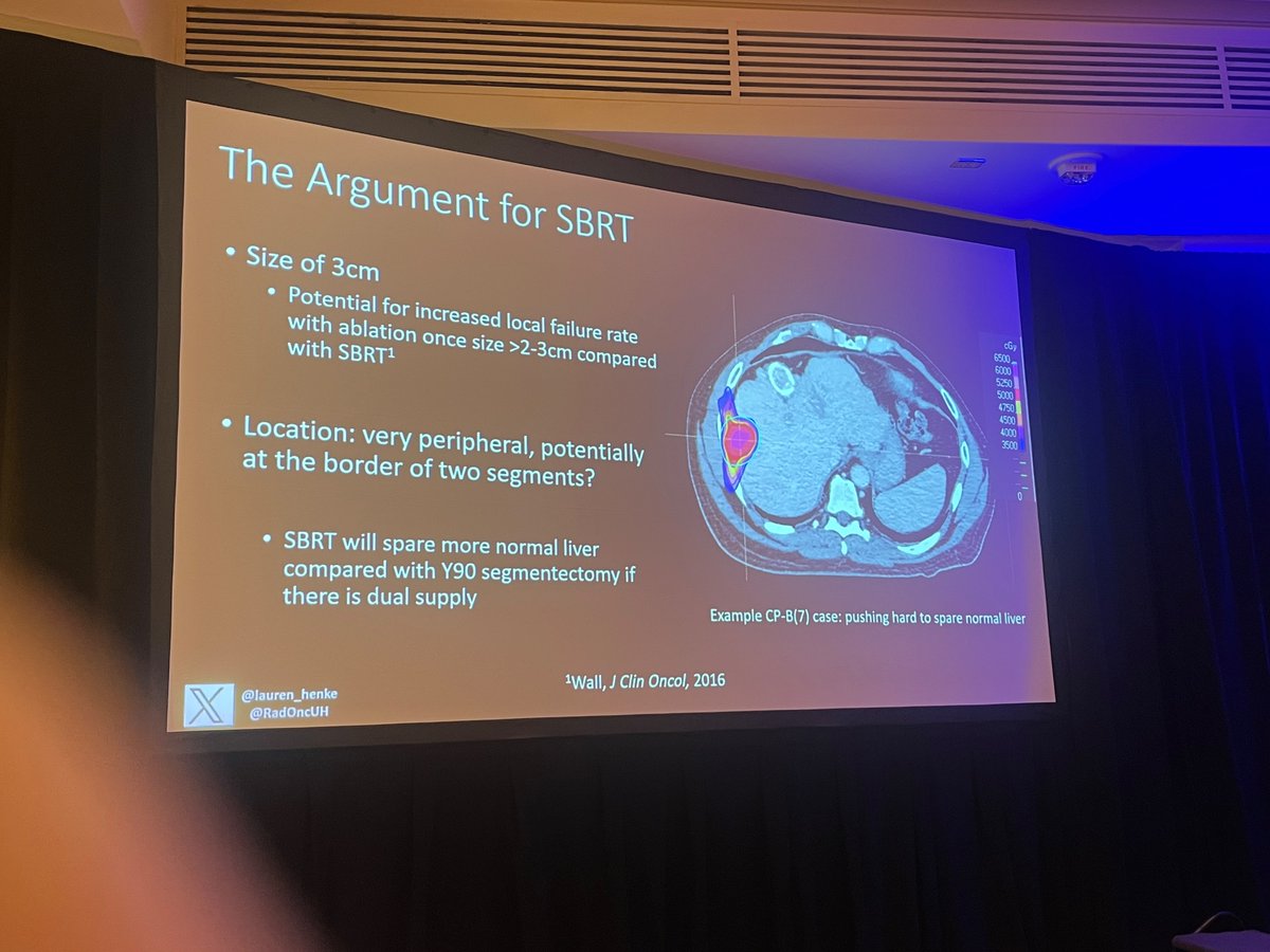 nbn426's tweet photo. #SALCS 2024 tumor board on challenging HCC cases. @lauren_henke is crushing it explaining not only the data for SBRT but also the vast array of tools we have at our disposal (cbct, lipodol, fiducials, adaptive , motion management, beam control ) to ensure safe and highly effective doses to definitively treat HCC.