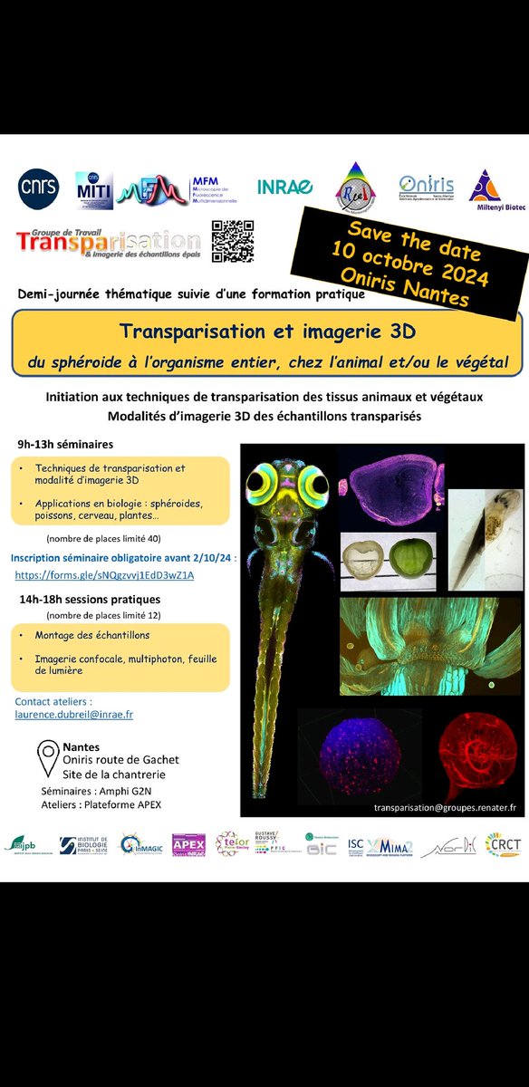 Guillermet's Lab (@guillermetlab) on Twitter photo Under the ☀️ of Nantes, <a href="/RominaDAngelo16/">Romina D'Angelo</a> shared her great expertise on imaging and clearing during trainings of the <a href="/RTMFM1/">MFM_Microscopy</a>. Under the ☀️ of Nantes, <a href="/RominaDAngelo16/">Romina D'Angelo</a> shared her great expertise on imaging and clearing during trainings of the <a href="/RTMFM1/">MFM_Microscopy</a>.
