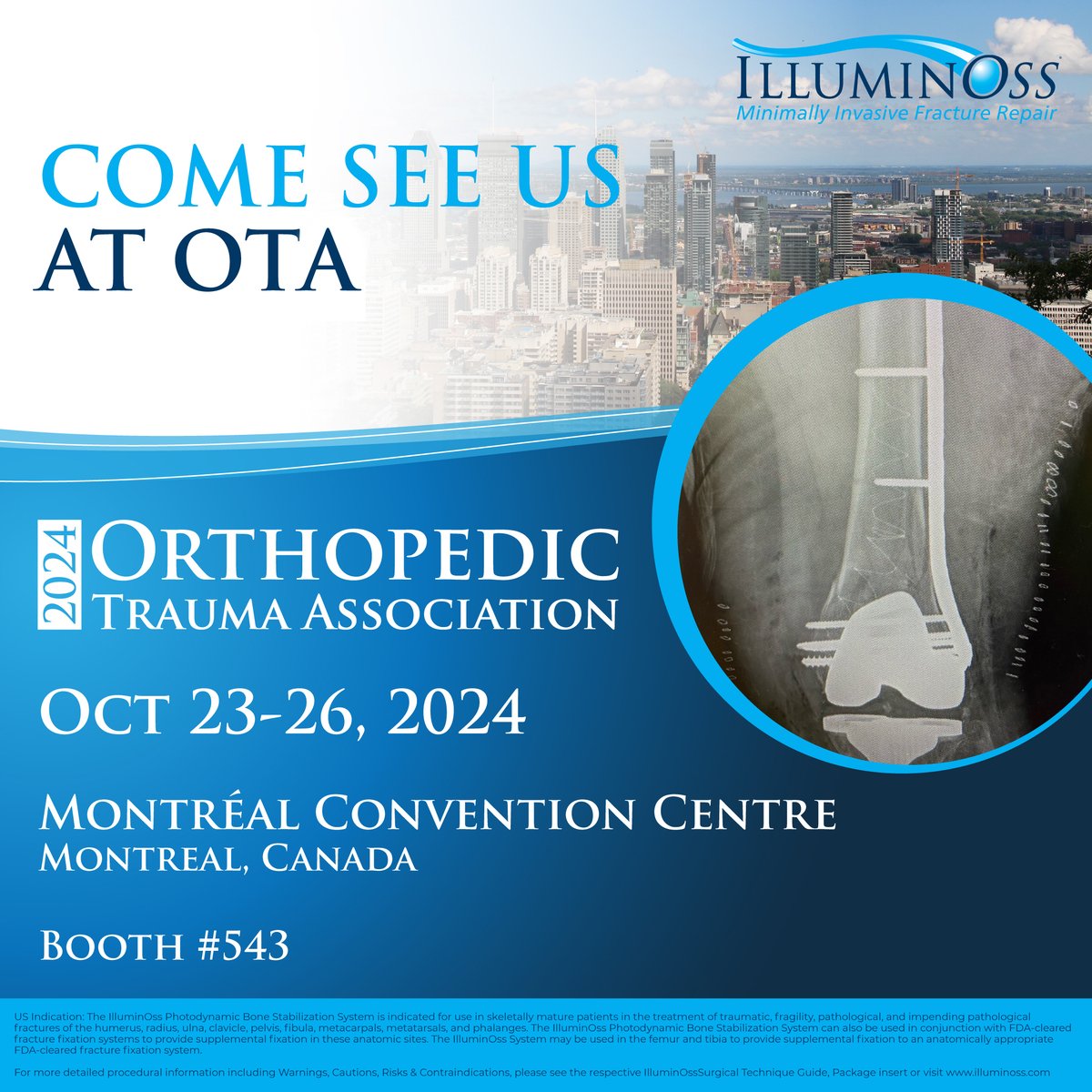 IlluminOss Medical tweet media