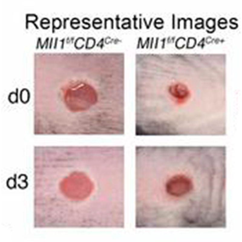 ASCI (@the_asci) on Twitter photo Striking a balance in diabetic wound repair. insight.jci.org/articles/view/…
ASCI member Katherine A. Gallagher's group reveals histone methyltransferase MLL1 as a potential target to limit pathologic inflammation. <a href="/BTBKGMD/">Katherine Gallagher</a> @UMichmed Striking a balance in diabetic wound repair. insight.jci.org/articles/view/…
ASCI member Katherine A. Gallagher's group reveals histone methyltransferase MLL1 as a potential target to limit pathologic inflammation. <a href="/BTBKGMD/">Katherine Gallagher</a> @UMichmed