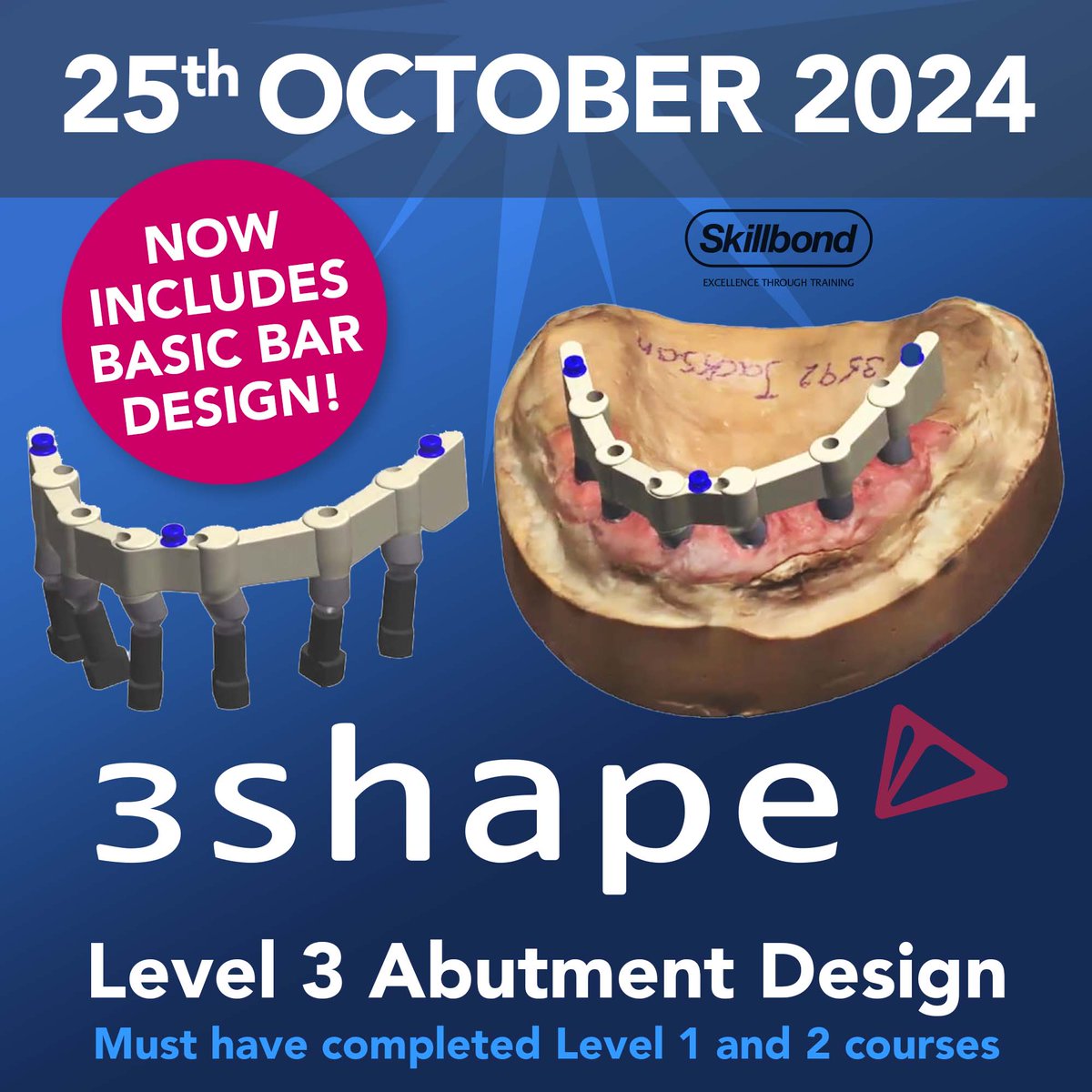 NEW ArgenIS Milled Bars.
- Direct to multi-unit abutment
- Fixed and removable bars at the abutment level
- Grade 23 Titanium and Cobalt Chrome 255
- Available in multiple implant systems
- Next Day turnaround
Basic bar design is available through our 3Shape Level 3 Course.