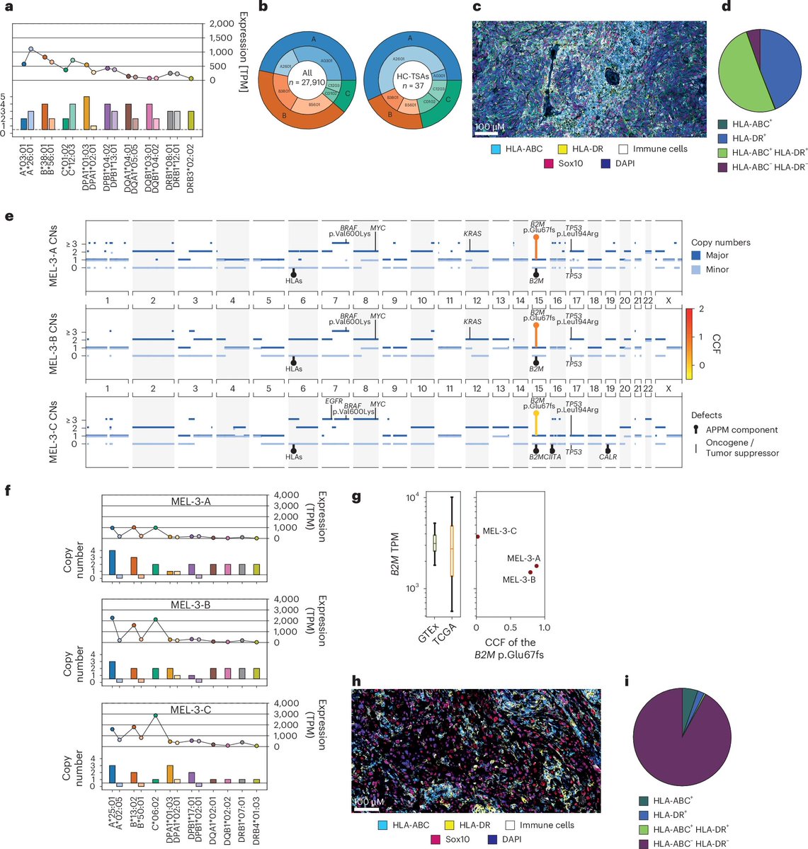 Waggoner Lab (@labwaggoner) on Twitter photo A comprehensive proteogenomic pipeline for neoantigen discovery to advance personalized cancer immunotherapy <a href="/NatureBiotech/">Nature Biotechnology</a> <a href="/michal_bassani/">Michal Bassani-Sternberg</a> nature.com/articles/s4158…
nature.com/articles/s4158… A comprehensive proteogenomic pipeline for neoantigen discovery to advance personalized cancer immunotherapy <a href="/NatureBiotech/">Nature Biotechnology</a> <a href="/michal_bassani/">Michal Bassani-Sternberg</a> nature.com/articles/s4158…
nature.com/articles/s4158…