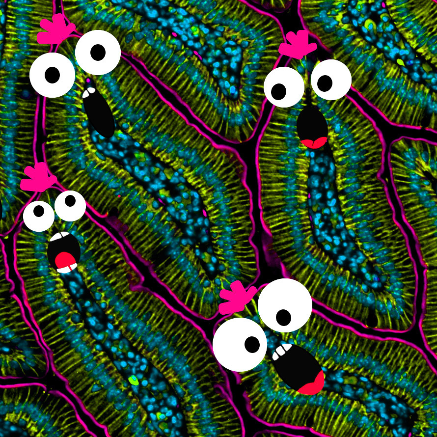Amy Engevik (@amyengevik) on Twitter photo This really encapsulates my week #FluorescenceFriday #MicrosCreepy This really encapsulates my week #FluorescenceFriday #MicrosCreepy