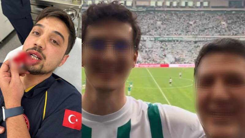 Kalp krizi geçiren hasta hayatını kaybetti. 

📌Olay sonrası gözaltına alınan baba serbest kalırken saldırıyı gerçekleştiren oğlu tutuklandı.

📌Darp edilen sağlık çalışanıyla görüştüğümde kameranın açısı dışında ilk saldırıyı yapan Bursa’da iş adamı olarak tanınan Selim Y.