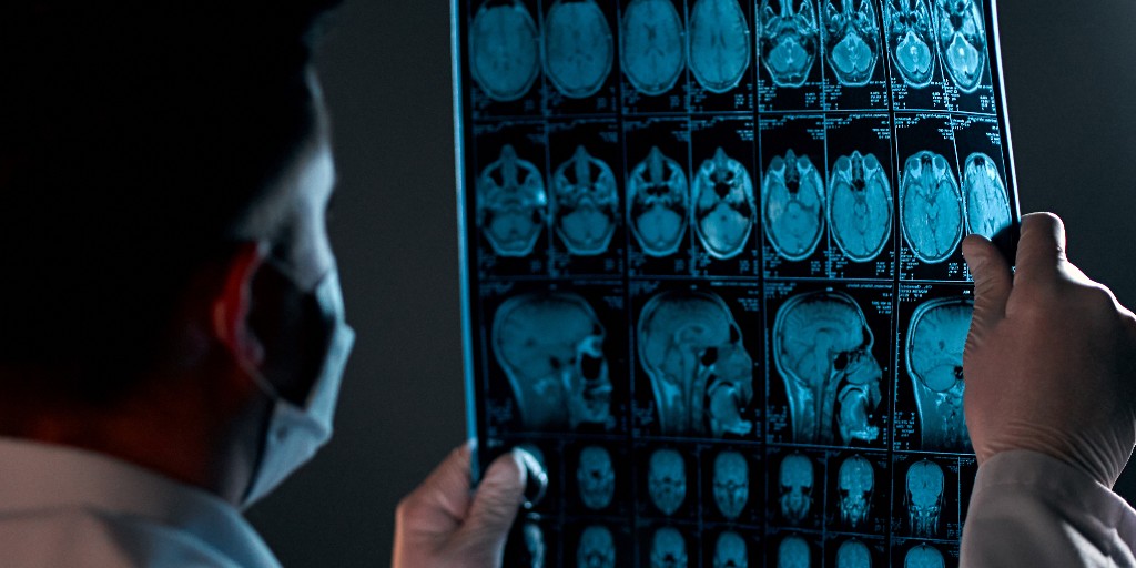 MedCentral (@medcentralmd) on Twitter photo 🩺 A new study shows 73% of #CPP patients may also have neurological conditions. Data presented at #PAINWeek2024 cautions for early screening. bit.ly/4daDZHj <a href="/TaliaDenis/">Talia Denis</a> 🩺 A new study shows 73% of #CPP patients may also have neurological conditions. Data presented at #PAINWeek2024 cautions for early screening. bit.ly/4daDZHj <a href="/TaliaDenis/">Talia Denis</a>