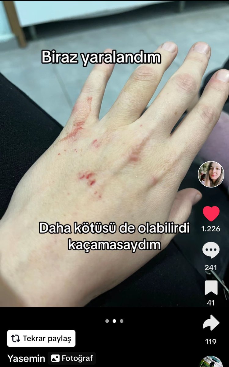 t0xickwss's tweet photo. kızlar bu abla uzun suredır 2 cocuguyla tek basına yasıyor sanırım eskı esı saldırmıs ımkanı olan ulasabılır mı lutfen 🙏🏿🙏🏿 https://t.co/75jpPWWre4