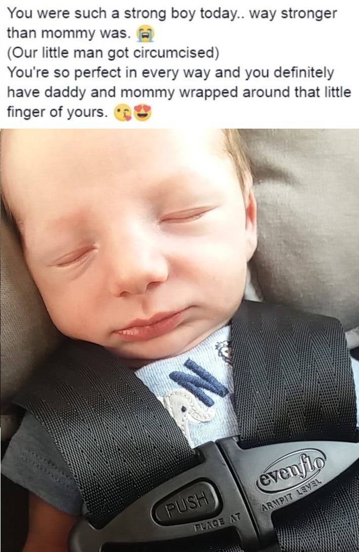 This unconscious state after circumcision has long been trivialized as mere sleep, but it is more like the shock coma of a person after severe trauma and injury.  The man-to-be is diminished and injured for life, and will never know it. That of course is the purpose of MGM &amp; FGM.