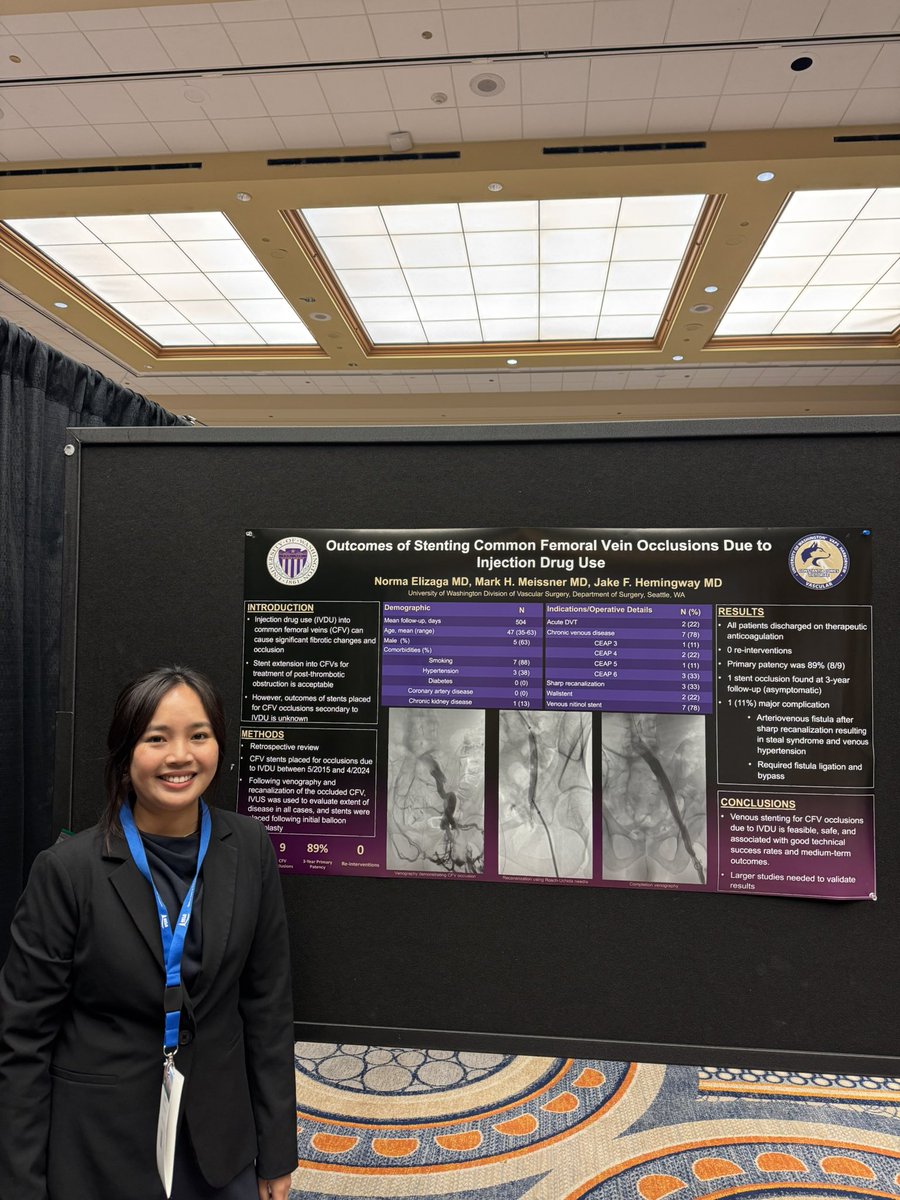 Jake Hemingway (@jfhemingway) on Twitter photo Research fellow Norma Elizaga did a great job discussing our work stenting occluded common femoral veins after injection drug use. Tough but rewarding cases <a href="/UWVascsurg/">UW Vascular</a> Research fellow Norma Elizaga did a great job discussing our work stenting occluded common femoral veins after injection drug use. Tough but rewarding cases <a href="/UWVascsurg/">UW Vascular</a>