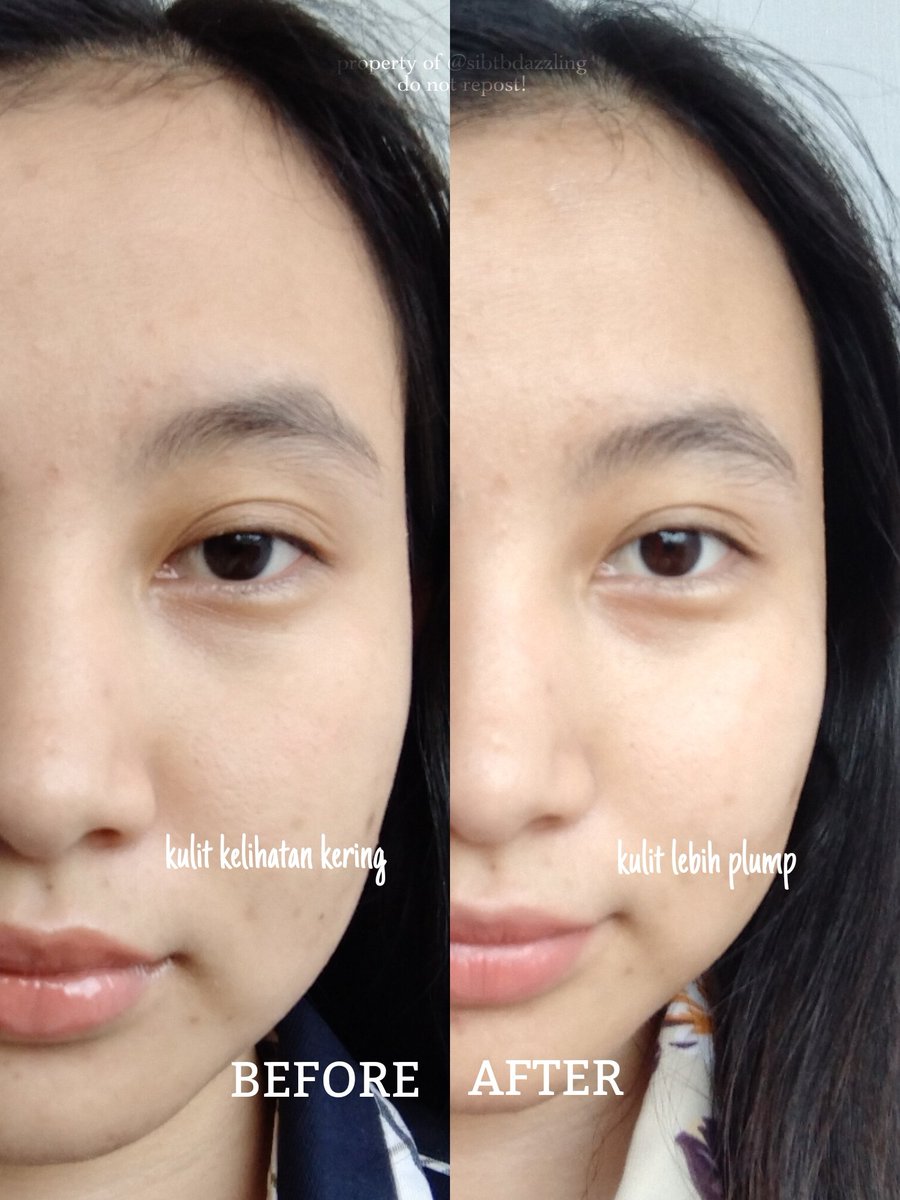 sibtbdazzling's tweet photo. BUSET ELFORMULA NIH GA HABIS-HABIS GEBRAKANNYA😭🙌🏻✨
kayanya baru sebulanan launching mugwort sunscreen sekarang udah launching moistirizer cream TARGETED buat DRY & SENSITIVE SKIN😮✨🥹
moist yang udah aku tunggu-tunggu extra hydrationnya ✨
#MellsRoom https://t.co/v7LShB1PPE