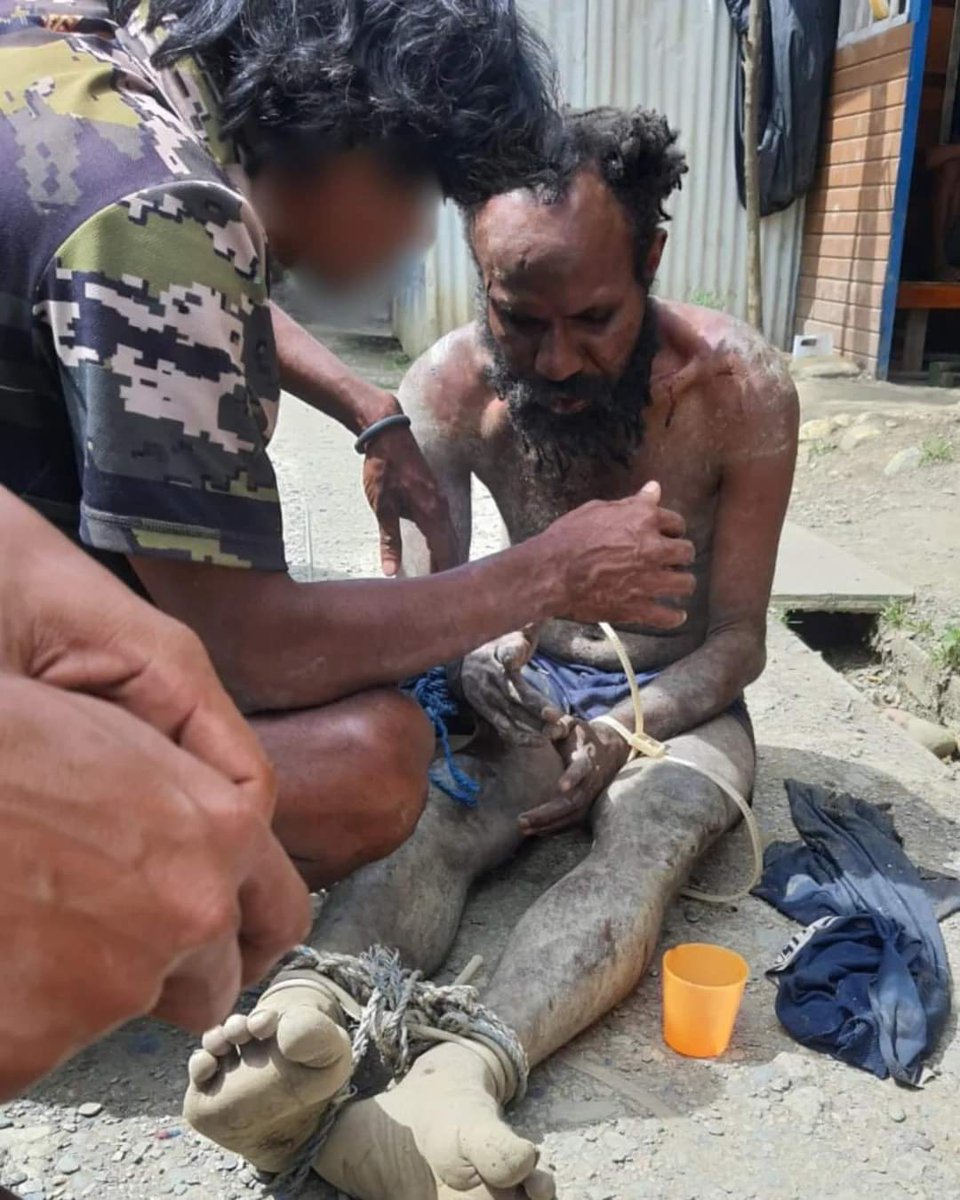 HevalZenar's tweet image. Indonesian Terrorist Yonif 509 torturing innocent West Papuan disabled mental disorder Alex Sondegau in Intan Jaya Regency

westpapuanews.org/indonesian-ter…

#FreeWestPapua 
#IndonesiaFascistState #Coloniser  #IndonesiaTerroristState #IndonesiaApartheidState #IndonesiaStopKillingPapuans