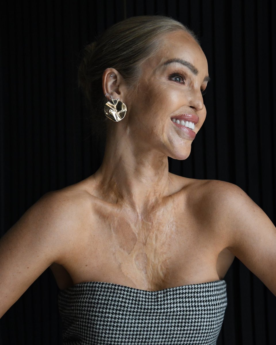 Today is my 41st birthday.

In a year where so much has changed, I am celebrating that change. My health has continued to take some hits, but raising my to daughters and spending the days being able to empower them as women continues to be the greatest gift.