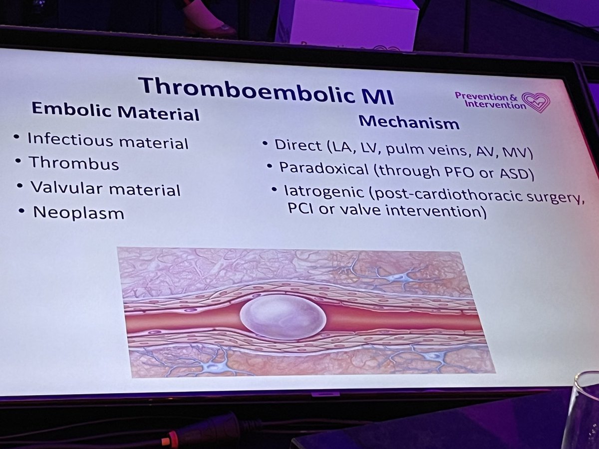 <a href="/CVPrevInterv/">CVPrevInterv</a> <a href="/ShrillaB/">Dr Shrilla Banerjee MD FRCP 💙</a> MI in the young..not one entity &amp; includes premature ASCVD

Interesting to see the <a href="/TheLancet/">The Lancet</a> commission recommendations for premature IHD including gene silencing &amp; injectables to address factors like obesity

<a href="/rallamee/">Rasha Al-Lamee</a> <a href="/DrSarahjZaman/">A/Prof Sarah Zaman</a> <a href="/DFCapodanno/">Davide Capodanno</a>