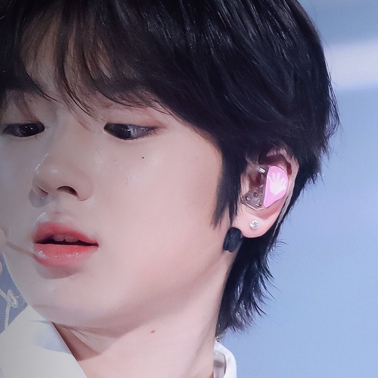 아니윗입술이거의사라졋는데지금