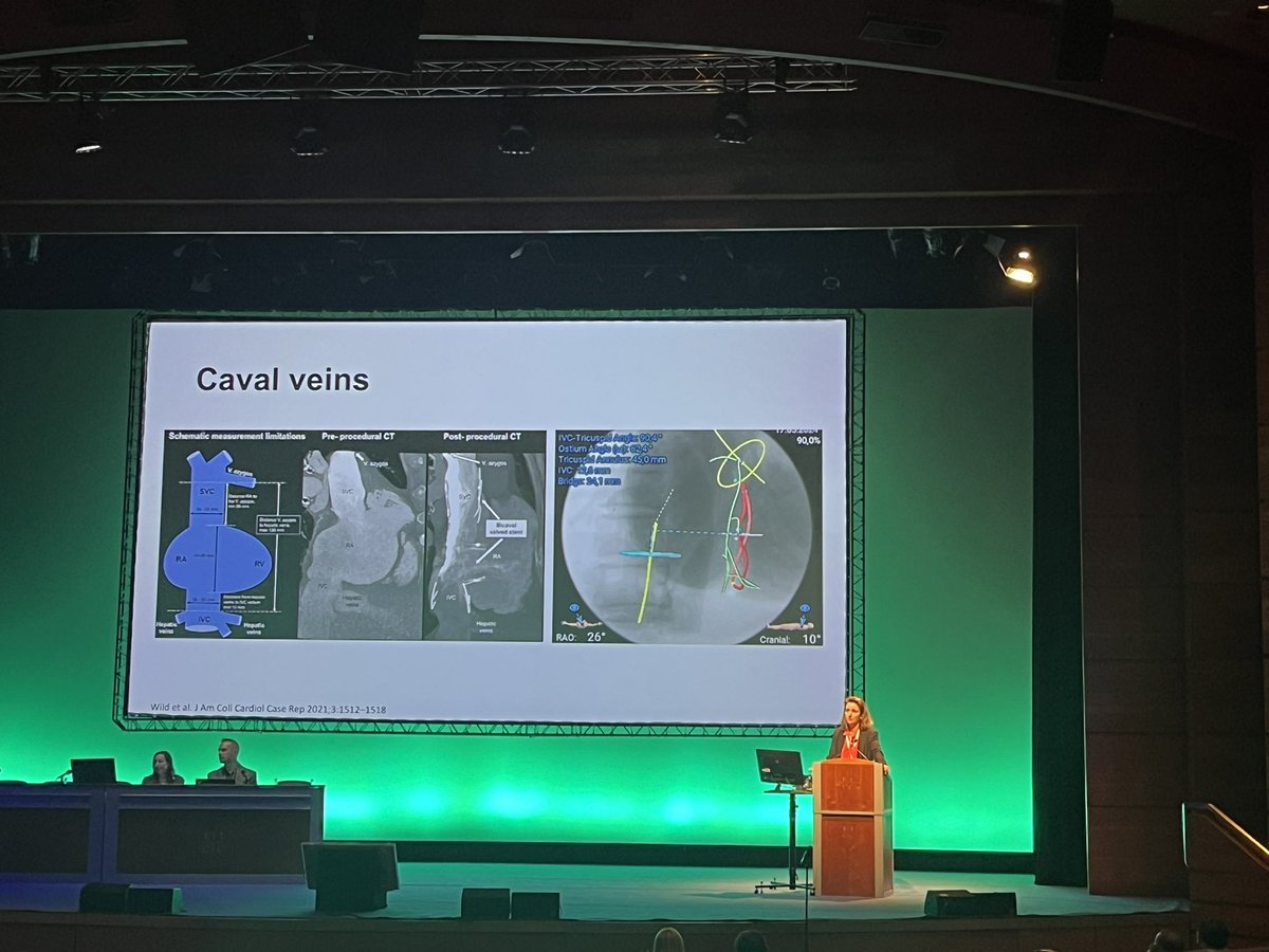Prof Dan Augustine (@danxaugustine) on Twitter photo Fantastic lecture <a href="/VDelgadoGarcia/">Victoria Delgado</a> <a href="/BSEcho/">BSEcho</a> conference <a href="/EACVIPresident/">EACVI President</a> #BSEcho2024 : A systematic approach to TR imaging for intervention:
💥Know anatomy & understand the mechanism
💥Biplane / 3D views very important
💥Don’t forget to image the vena cava in preparation planning Fantastic lecture <a href="/VDelgadoGarcia/">Victoria Delgado</a> <a href="/BSEcho/">BSEcho</a> conference <a href="/EACVIPresident/">EACVI President</a> #BSEcho2024 : A systematic approach to TR imaging for intervention:
💥Know anatomy & understand the mechanism
💥Biplane / 3D views very important
💥Don’t forget to image the vena cava in preparation planning