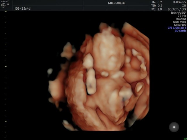 #infertilpreñis #infertilmamis Ayer la eco fue muy bien, aunque bebé se quiso esconder en la placenta a mitad de la eco y de ahí no se movió 🤭 Hicimos revelación en la misma clínica con 🎈 y es... ¡NIÑA! 🦔💜