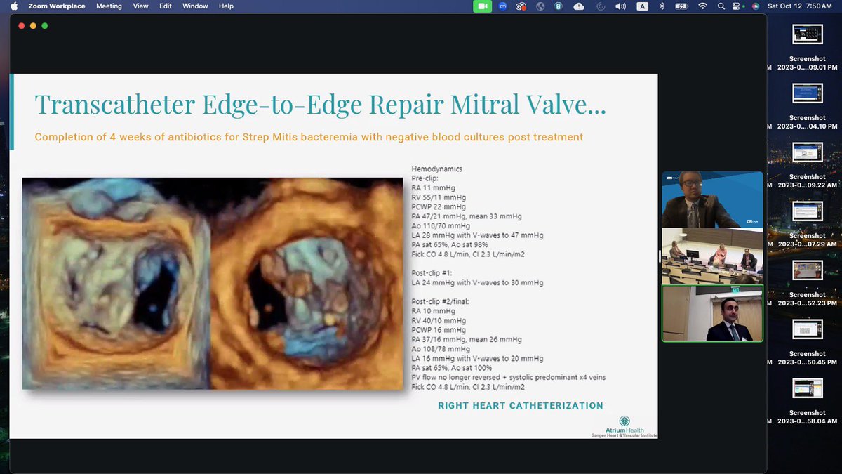 Eric H Yang, MD (@datsunian) on Twitter photo Fantastic #cardioonc <a href="/AtriumHealth/">Atrium Health</a> <a href="/AtriumSHVI/">Atrium Health Sanger Heart & Vascular Institute</a> symposium held by <a href="/amar_parikh/">Amar Parikh</a> & #jaisingh!!
Great discussions of cases ranging from cardiogenic shock, TEER, complex PCI in the setting of cancer and cardiotoxicity.
Really a great inaugural mtg! Congrats guys!! Fantastic #cardioonc <a href="/AtriumHealth/">Atrium Health</a> <a href="/AtriumSHVI/">Atrium Health Sanger Heart & Vascular Institute</a> symposium held by <a href="/amar_parikh/">Amar Parikh</a> & #jaisingh!!
Great discussions of cases ranging from cardiogenic shock, TEER, complex PCI in the setting of cancer and cardiotoxicity.
Really a great inaugural mtg! Congrats guys!!
