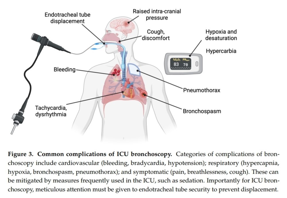jpedrokessner tweet media