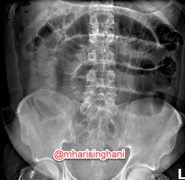 Mukesh Harisinghani tweet media