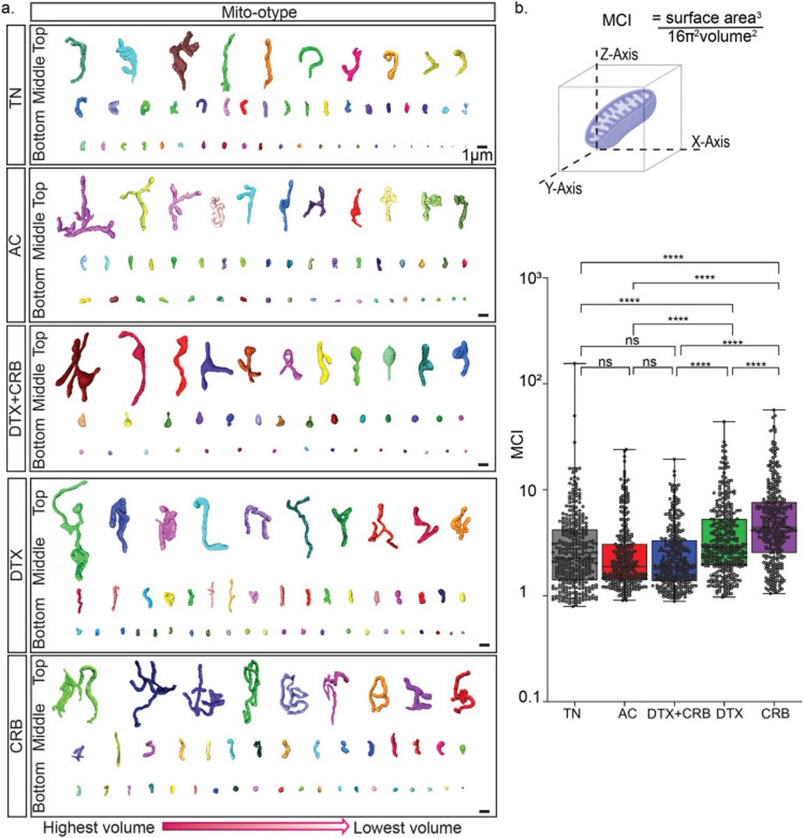 Antentor Othrell Hinton, Jr PhD (A.J. Hinton) (@phdgprotein86) on Twitter photo <a href="/AtHinton/">Hinton Laboratory at Vanderbilt</a> lab does it again! Congrats <a href="/Mariah_mito/">Mariah</a> & <a href="/HKbeasley/">Heather K. Beasley, PhD, MS</a> <a href="/VUBasicSciences/">Vanderbilt School of Medicine Basic Sciences</a> <a href="/VUMCDiscoveries/">Vanderbilt University Medical Center</a>! So proud of your co-first paper on 3D analysis of mitochondria in a PDX model of triple-negative breast cancer! 🧬💪 Shoutout to <a href="/DrGEcheverria/">Gloria V. Echeverria, Ph.D.</a> from <a href="/BCMFromtheLabs/">From the Labs at Baylor College of Medicine</a> <a href="/BCMDeptMedicine/">BCM Department of Medicine</a> <a href="/AtHinton/">Hinton Laboratory at Vanderbilt</a> lab does it again! Congrats <a href="/Mariah_mito/">Mariah</a> & <a href="/HKbeasley/">Heather K. Beasley, PhD, MS</a> <a href="/VUBasicSciences/">Vanderbilt School of Medicine Basic Sciences</a> <a href="/VUMCDiscoveries/">Vanderbilt University Medical Center</a>! So proud of your co-first paper on 3D analysis of mitochondria in a PDX model of triple-negative breast cancer! 🧬💪 Shoutout to <a href="/DrGEcheverria/">Gloria V. Echeverria, Ph.D.</a> from <a href="/BCMFromtheLabs/">From the Labs at Baylor College of Medicine</a> <a href="/BCMDeptMedicine/">BCM Department of Medicine</a>