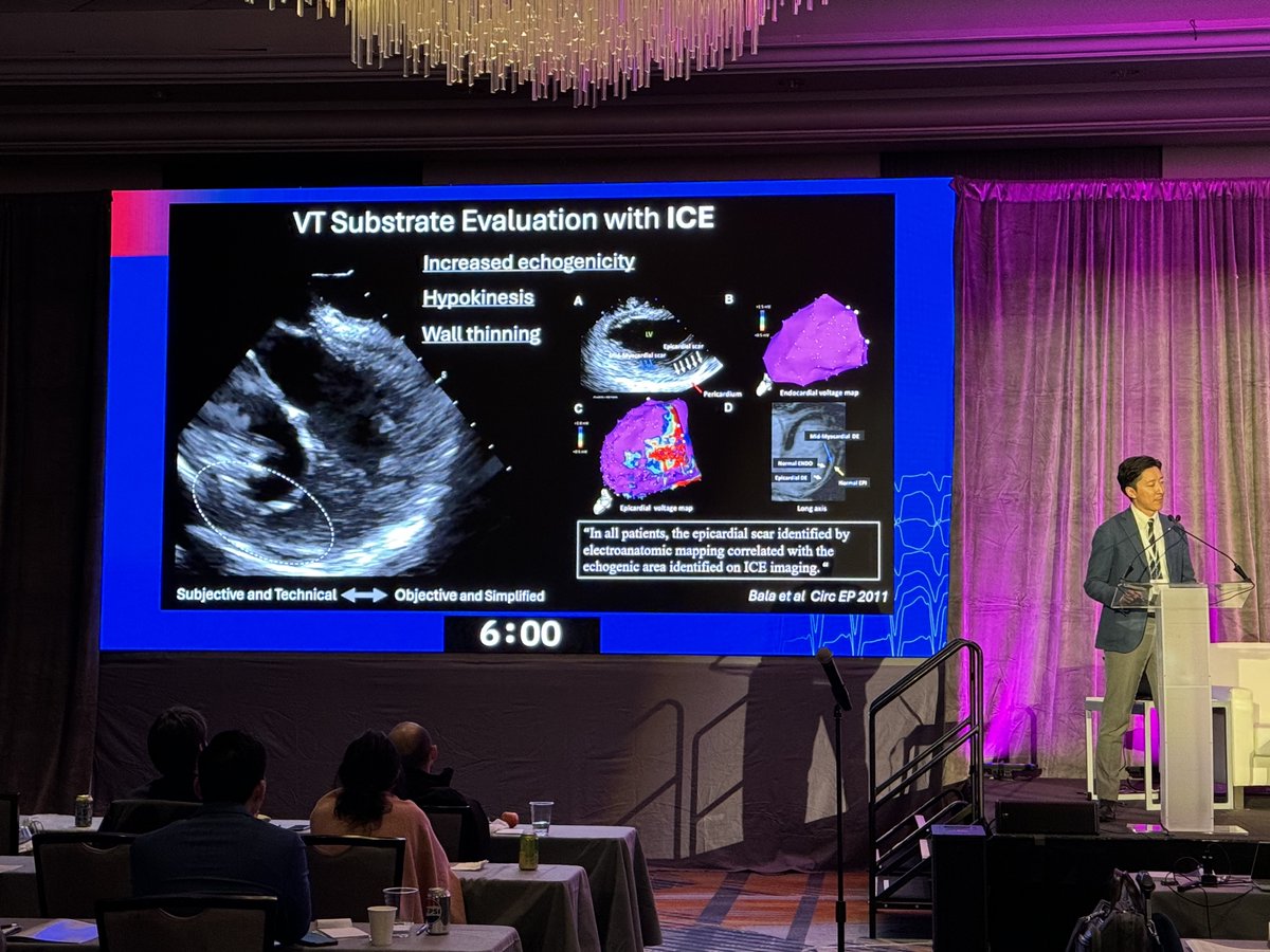 Dr. Naohiko Sahara <a href="/NaohikoSahara/">Naohiko Sahara</a> presents on ICE for the detection of arrhythmogenic periaortic substrate during the 2024 VT Symposium Mark E. Josephson Abstract Competition. #EPeeps #cardiotwitter #MEDTwitter #Cardiology