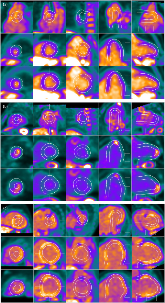 Venk Murthy MD PhD tweet media