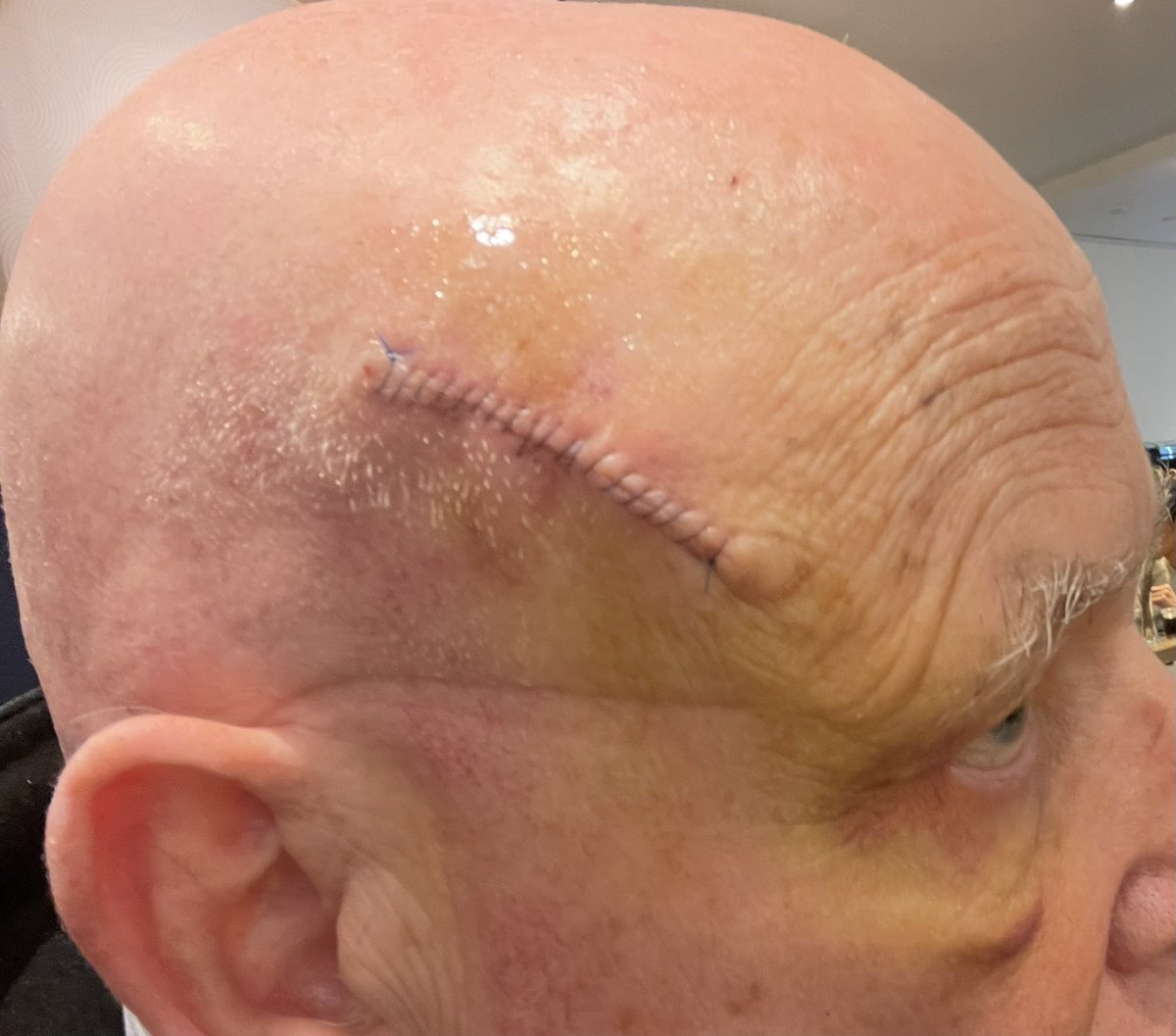 Andrew Corbett-Nolan tweet media