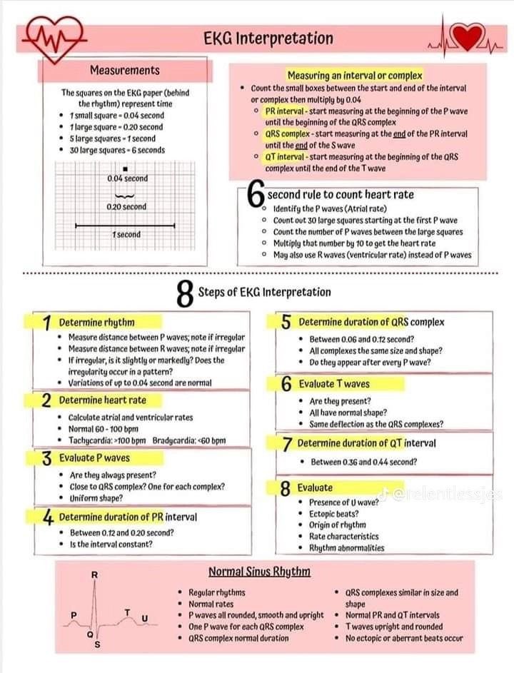 Ph_LamaAlghamdi's tweet photo. ECG Interpretation 🫀 https://t.co/B1nPpR64sx