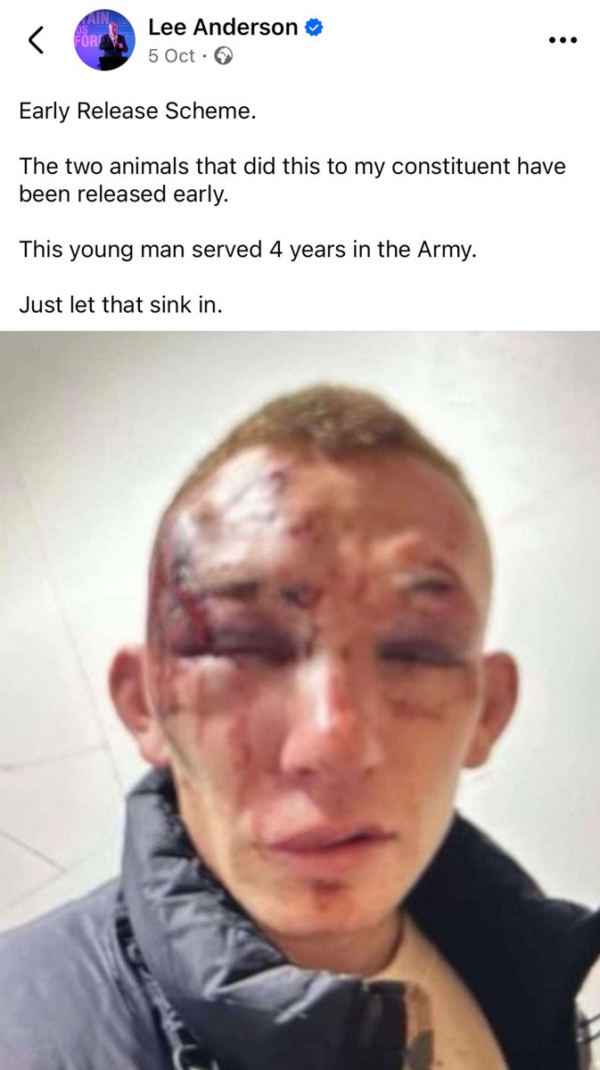 Lee Anderson needs to post some proof that this happened, who this is.

It’s an old case, the men were obviously convicted and have since been released. 

There’s no reason for him to not.

Unless it’s another Travelodge moment for Lee.