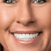 I finally figured out that the whiter the teeth, the stupider the politician...