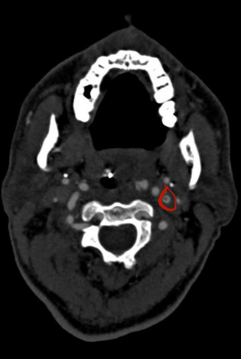 Andrew Micieli tweet media