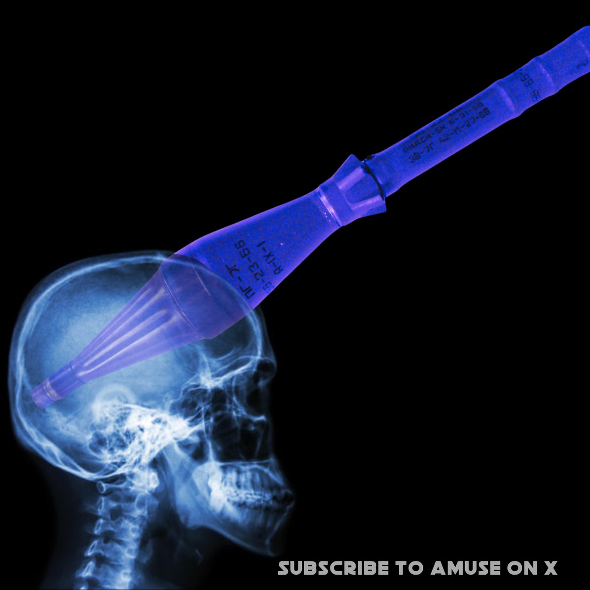 SHOCK: The IDF is firing 85mm PG 7 Rockets into the heads of innocent Palestinian children. Here is an x-ray showing the devastating damage the rocket causes. The child is expected to recover but will have a large hold in their head. [this is satire]