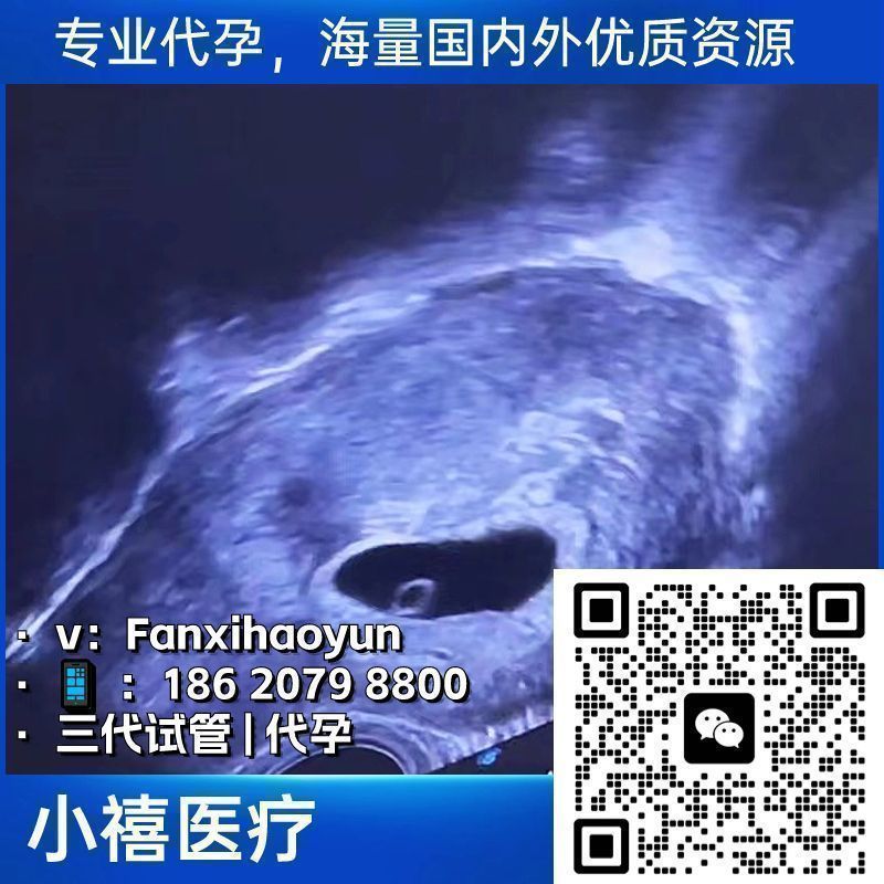 【试管代孕】凡禧医疗 tweet media