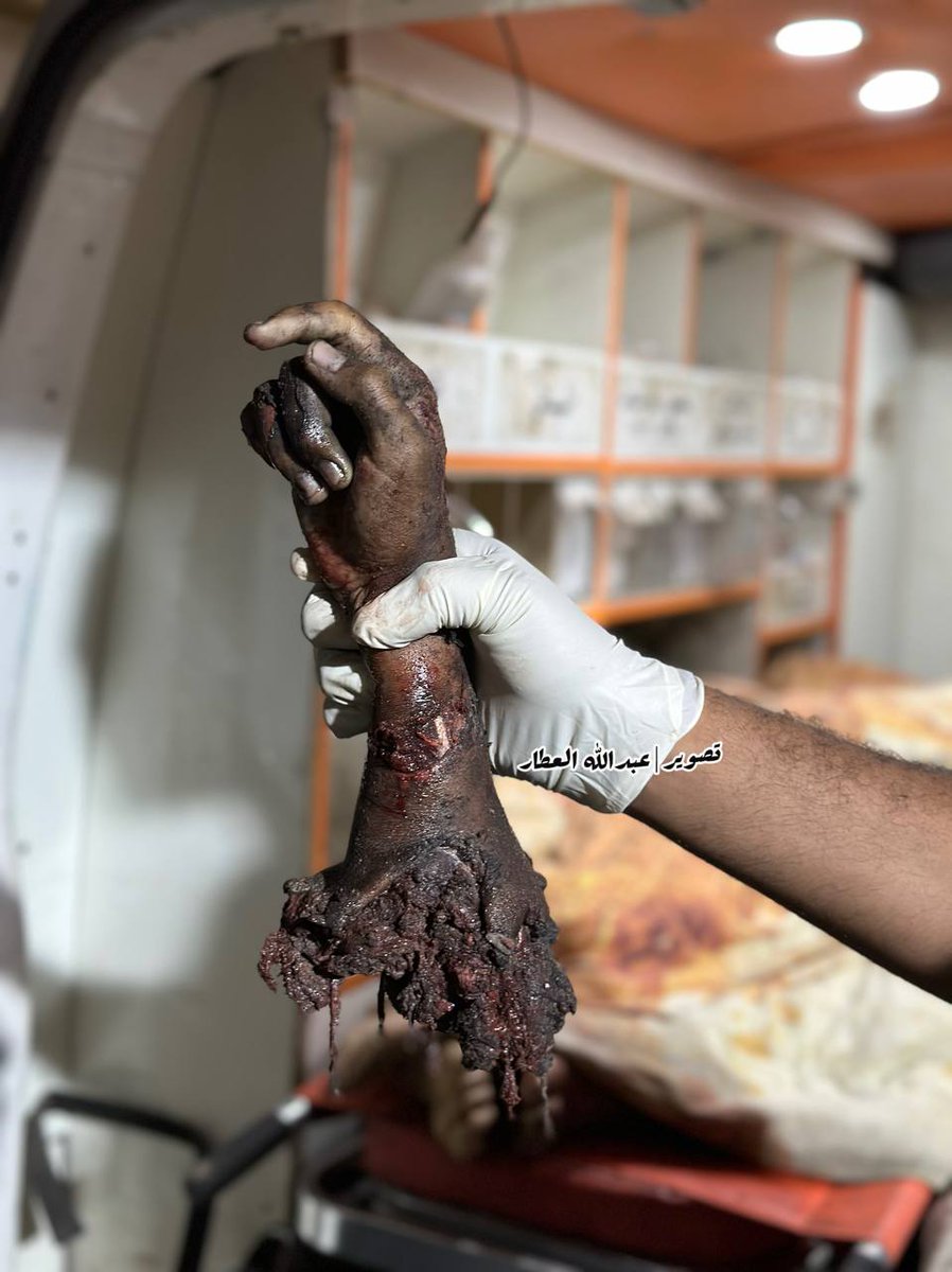 هذه السبابة المرفوعة  باليد هي بقايا أجساد عائلة فلسطينية حولتها الصواريخ الاسرائيلية إلى اشلاء.. 

7 شهداء اختلطت اجسادهم ببعضهم البعض ولم يتم معرفتهم..

#شمال_غزة_تُباد 
#مخيم_جباليا