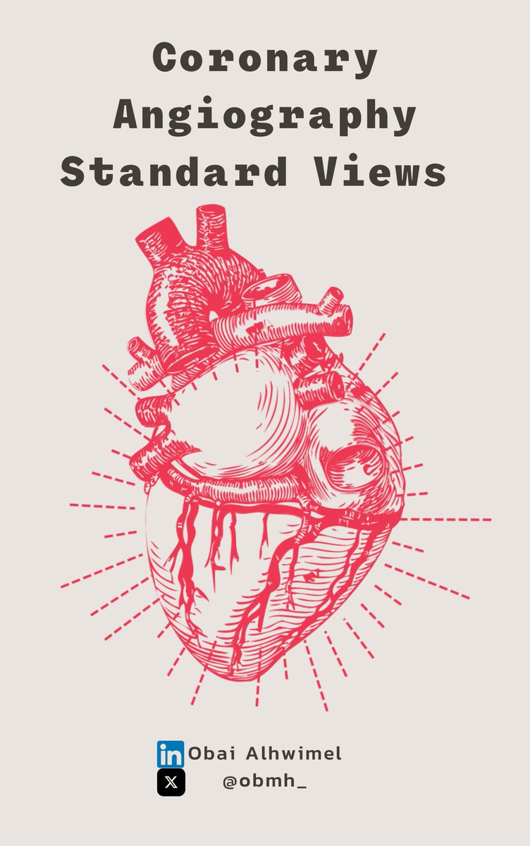 obmh_'s tweet photo. ▪️Optimal angiographic views for invasive coronary angiography🫀
▪️المنظورات الإشعاعية المثالية لتصوير الشرايين التاجية🫀
#cathlab #cath_lab #interventional_cardiology #artery https://t.co/XEz3DORG61