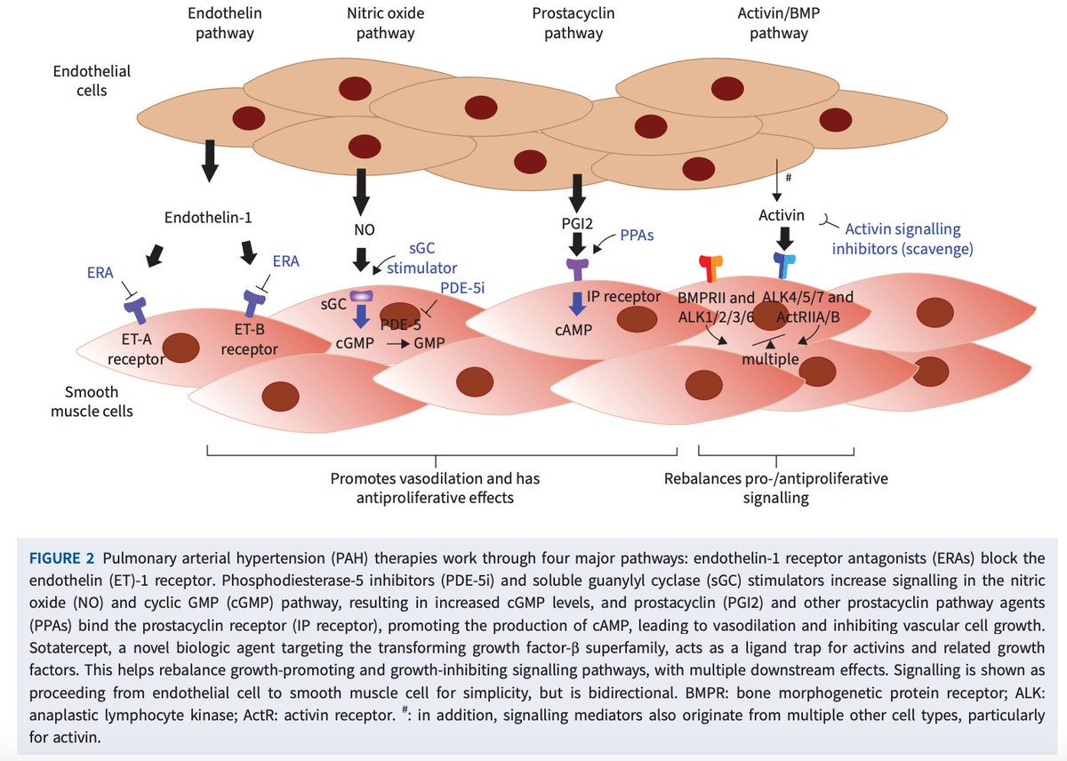 SeguraCardio's tweet photo. 🆕Treatment algorithm for pulmonary arterial hypertension‼️

#PAH #WSPH2024 #Guidelines https://t.co/sOfRx8FPu8
