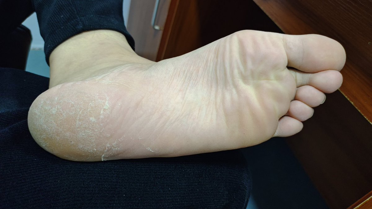 kaikkkSSS's tweet photo. 这鸡巴拖鞋穿的，全他妈死皮 https://t.co/rEvvex5lLK
