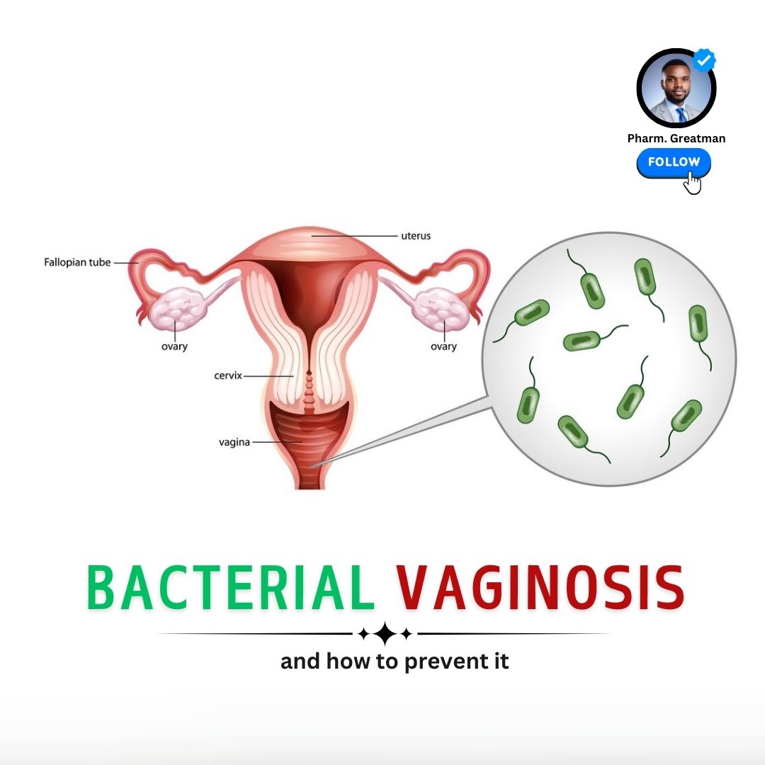 Bacterial vaginosis (BV) affects millions of women but is often misunderstood! 

Are you curious about its causes, symptoms, and how to maintain a healthy balance? Let’s break it down

Scroll up ⬆️
