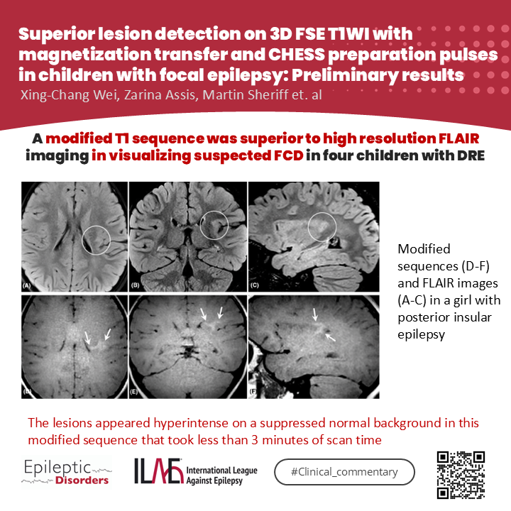 Epileptic Disorders (@epidisorders) on Twitter photo 💡Wei et al. show benefit of magnetization transfer & chemical shift selective preparation pulses + 3D fast spin echo T1-weighted sequence for visualization of FCD.
📃doi.org/10.1002/epd2.2…
<a href="/CyChuan/">Yong Chuan Chee</a> <a href="/SheikhISMD/">irfan sheikh 伊凡</a> <a href="/joanajribeiro/">Joana Ribeiro</a> <a href="/AlinaIvaniuk/">Alina Ivaniuk 🇺🇦</a> <a href="/SBeniczky/">Sandor Beniczky</a> <a href="/AnphyLab/">The AnPhy Lab</a> <a href="/IlaeWeb/">International League Against Epilepsy</a> 💡Wei et al. show benefit of magnetization transfer & chemical shift selective preparation pulses + 3D fast spin echo T1-weighted sequence for visualization of FCD.
📃doi.org/10.1002/epd2.2…
<a href="/CyChuan/">Yong Chuan Chee</a> <a href="/SheikhISMD/">irfan sheikh 伊凡</a> <a href="/joanajribeiro/">Joana Ribeiro</a> <a href="/AlinaIvaniuk/">Alina Ivaniuk 🇺🇦</a> <a href="/SBeniczky/">Sandor Beniczky</a> <a href="/AnphyLab/">The AnPhy Lab</a> <a href="/IlaeWeb/">International League Against Epilepsy</a>