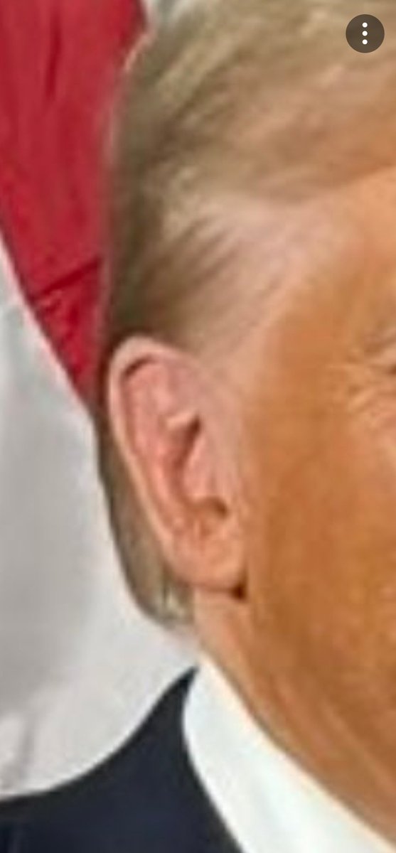 <a href="/MamaSissieSays/">Casey (she/her)</a> Is that the ear he was grazed by a bullet?

Where is the scar?