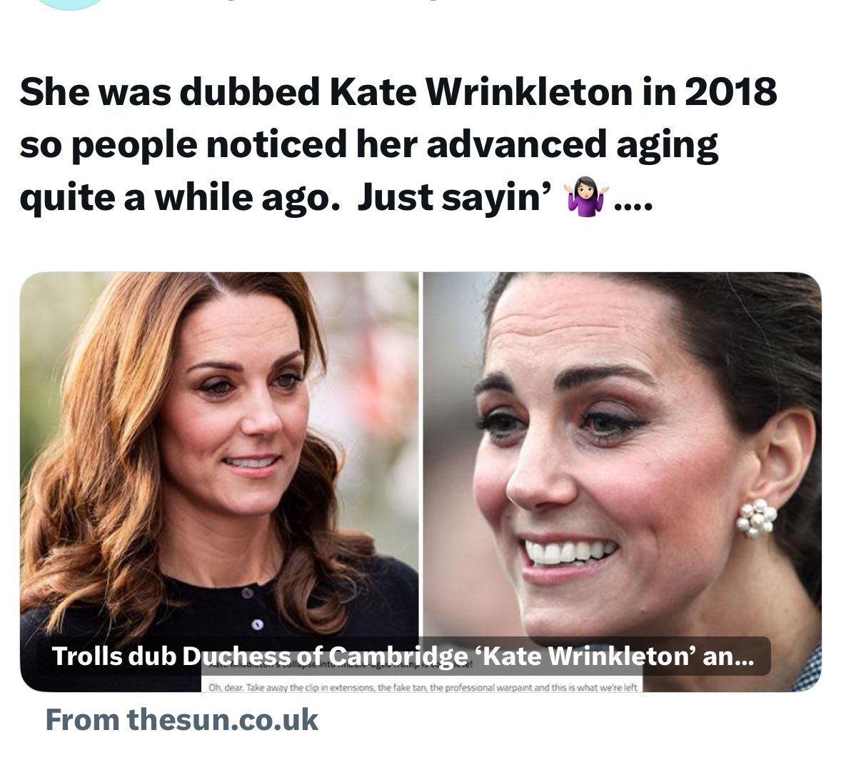MeghanTheQwin's tweet photo. This is what she looked like in 2018 & the sun called her Kate Wrinkleton 🤭 then she got her face done after that but then I guess Kate Wrinkleton is back 🤭 https://t.co/YgMdUUtDNo