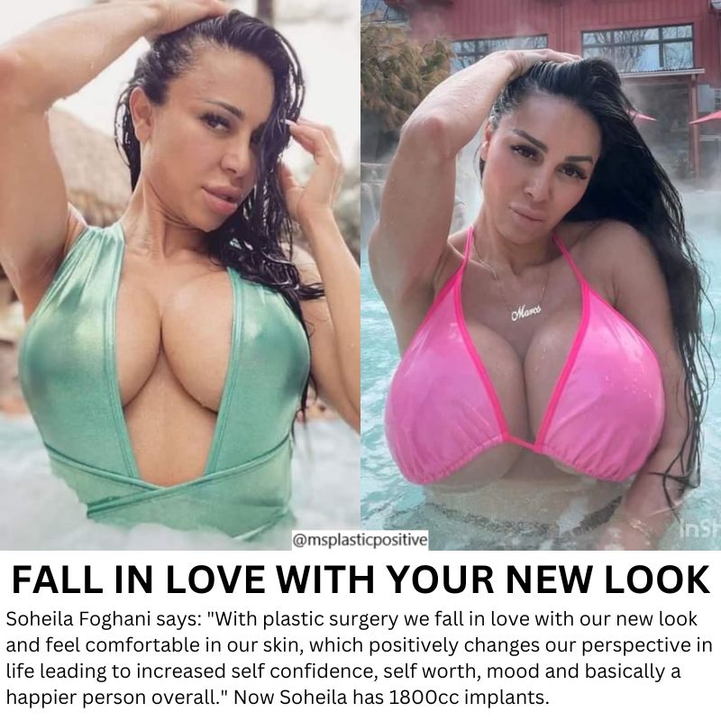 IG: soheila_ifbb_elite_pro #BreastAugmentation #breastimplants #plasticsurgery #cosmeticsurgery #fitnessgirl #FitnessMotivation #FitnessGoals #fitness #FitnessModel