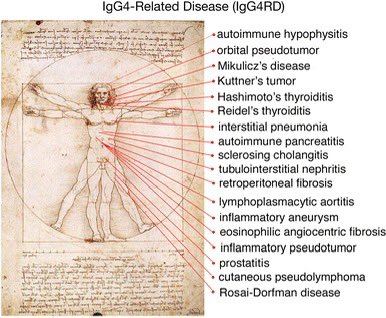 Willems0505's tweet image. Mitochondrial Diseases caused by the Spikeproteines in the mRNA?
