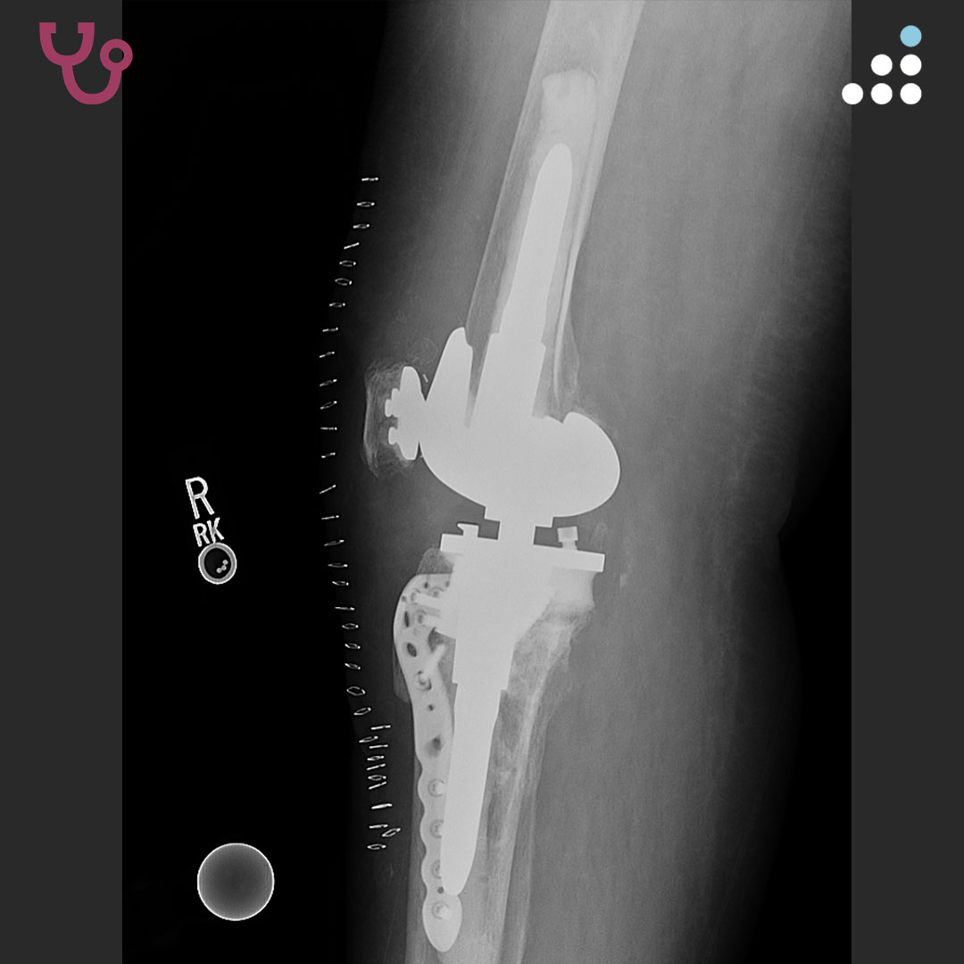 Orthobullets tweet media