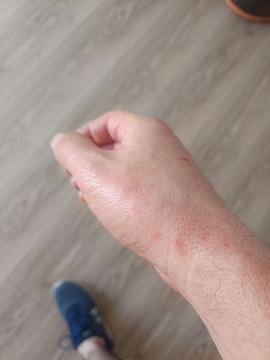 Iba por Playa Brava y con la brisa que hay me cayó una paloma de un candidato, no es mucho, pero molesta que pasen estas cosas. 
No hay a quien reclamarle. 
#Iquique