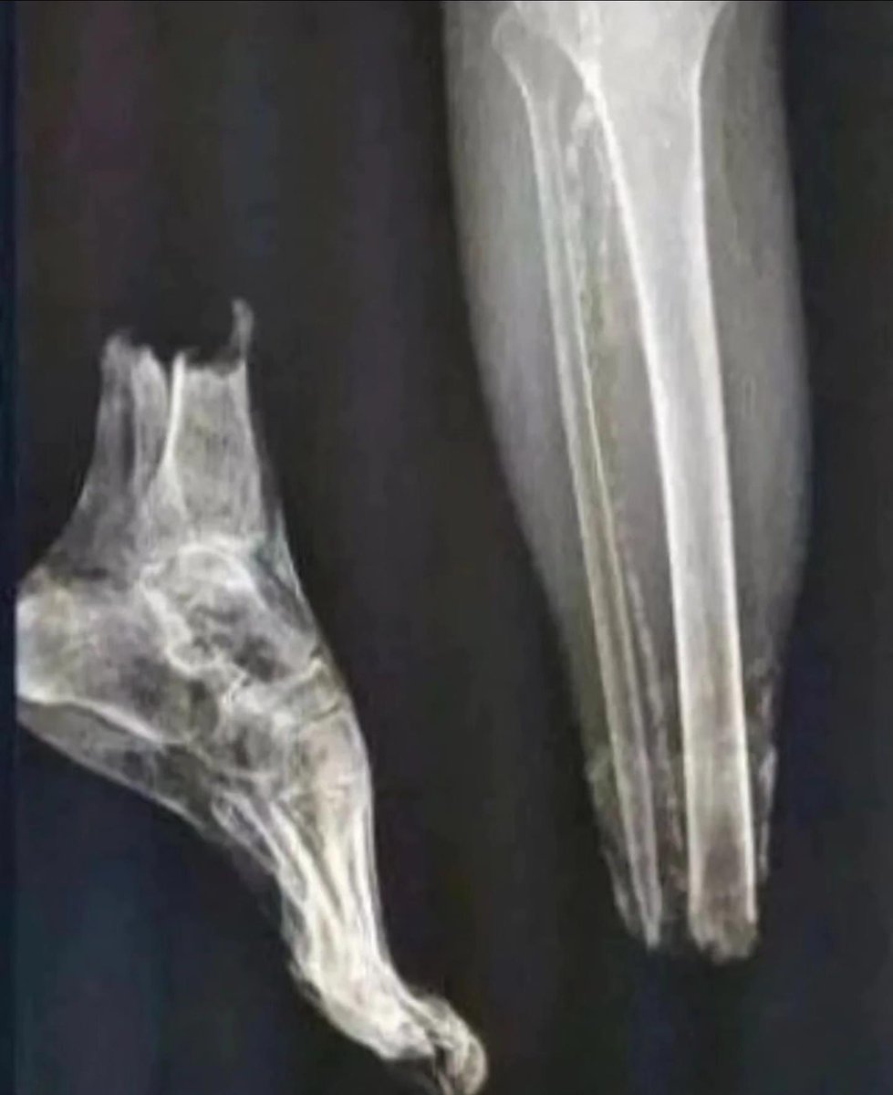 Loud Outside tweet media