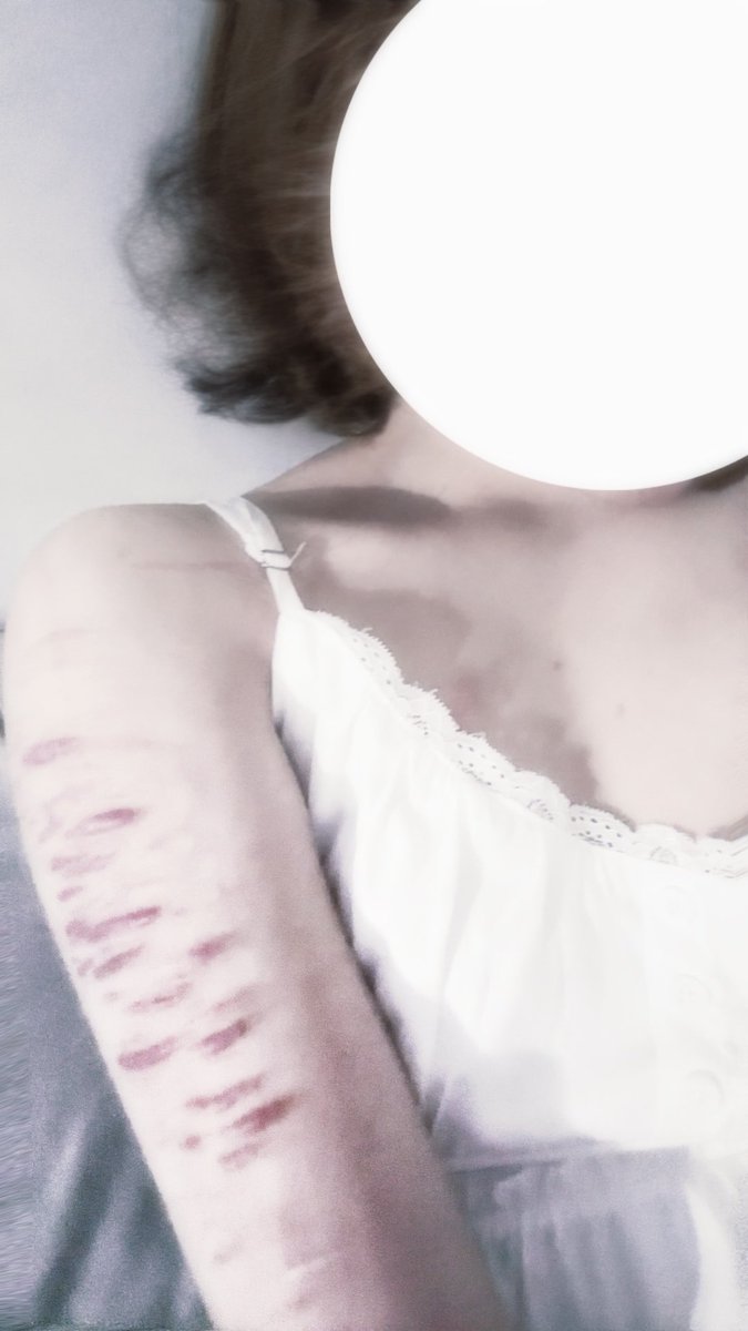 #selfharm
 #自残