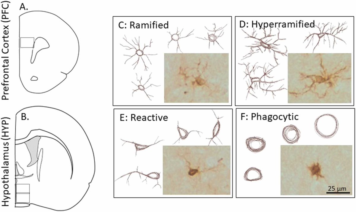 I am pleased to share our recent paper (my first first-author paper) on the long-term, sex-specific effects of perinatal exposure to an environmental contaminant (PCBs). This the third paper in a series looking at these effects in neonates, adolescents, and now, adults.