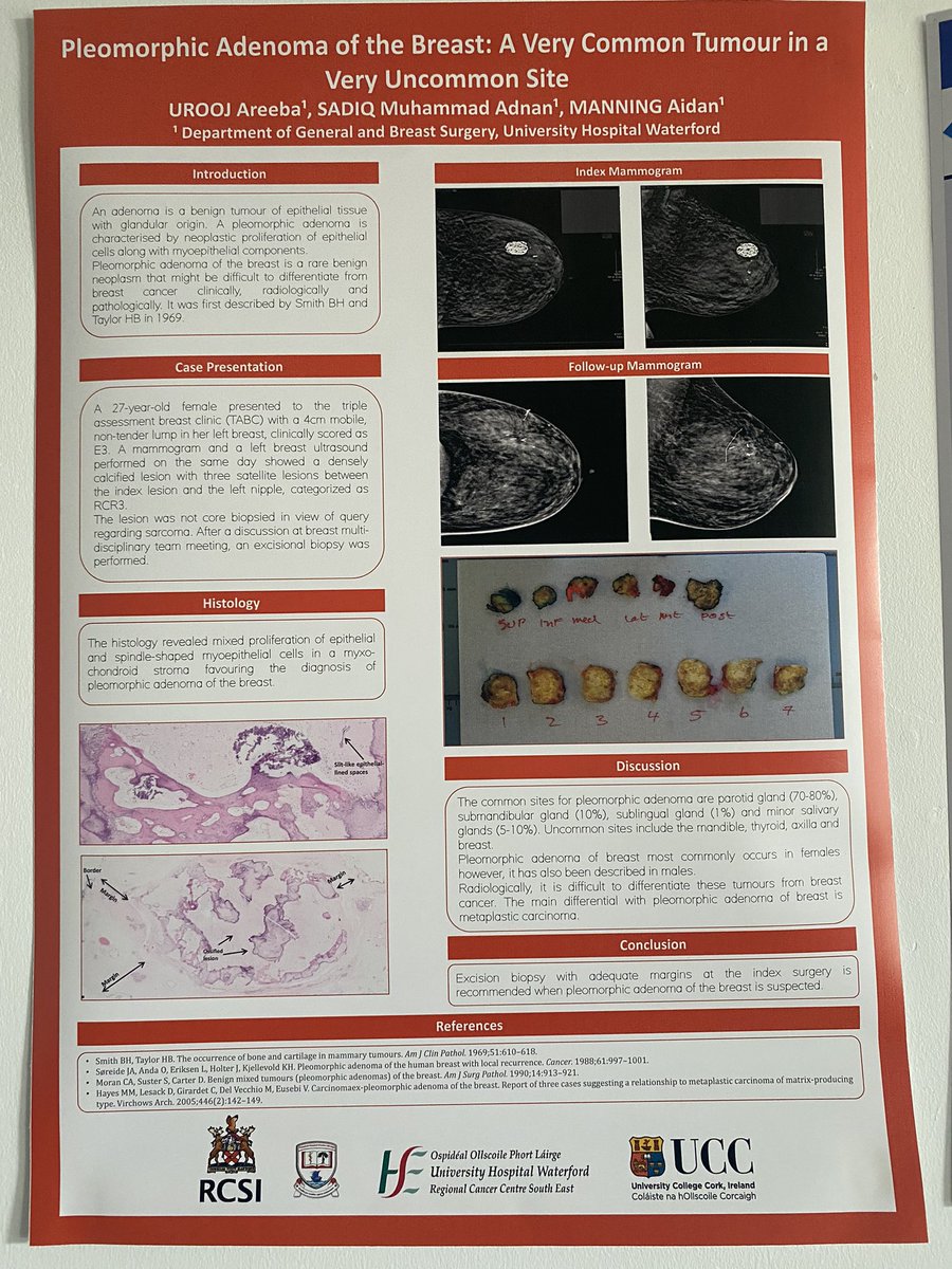 UHW Surgery (@surgeryuhw) on Twitter photo Congratulations Dr Sadie Muhammad Adnan on winning The Best General Surgery Mini-Poster Prize at The XXXIII Waterford Surgical October Meeting yesterday <a href="/UHW_Waterford/">Univ Hosp Waterford</a> Congratulations Dr Sadie Muhammad Adnan on winning The Best General Surgery Mini-Poster Prize at The XXXIII Waterford Surgical October Meeting yesterday <a href="/UHW_Waterford/">Univ Hosp Waterford</a>