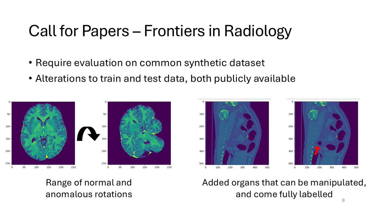 jemtan11's tweet image. Thanks again @d_zimmerer for the chance to address the MOOD community at #MICCAI2024! Our call for papers and accompanying dataset with @FrontMedTech are in the works. forms.gle/7gjF6R5YJ1rjNa… Until then, we’d love everyone’s input on how best to advance anomaly detection.
