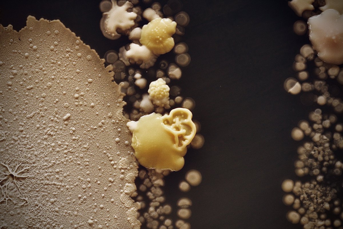 tasturm1's tweet image. #DescribeThatMicrobe I love how rich and varied the colors and textures are a month after these microbial #Handprints were done. @ASMicrobiology @HardyDiagnostic #Microbiology #Science #scicomm